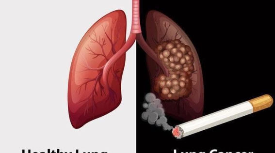 长期吸烟对健康的深远影响：专家告诉你戒烟后身体的变化