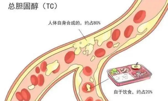 胆固醇不单是“敌人”：如何科学控制血脂，预防健康风险