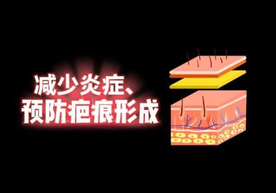 减少炎症、预防疤痕：痤疮治疗全攻略