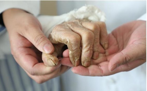 浙大邵逸夫阿拉尔医院再创断臂再植奇迹，展现医疗援疆的转型与突破