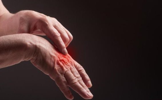 骨头痛也许不是关节炎，而是癌症的早期症状！及时检查，别让生命埋下隐患