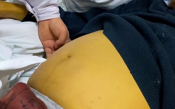 肝脏健康：三种必需营养，助力肝脏修复与保养