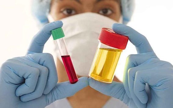 胆固醇数值不过度恐慌，科学管理才是关键