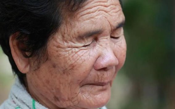 如何通过改善营养，预防老年斑的生成