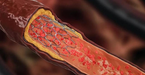 血管决定生死，探究衰老背后的秘密