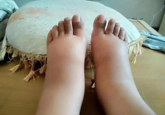 服用降压药不注意这些细节，肾脏可能会受害！