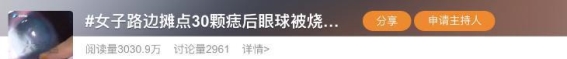 警惕！街边点痣可能导致眼球烧伤的真实案例