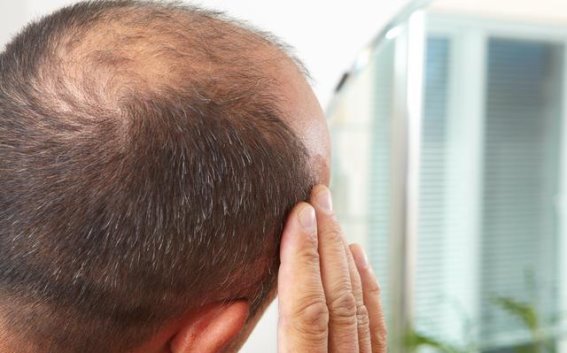 警惕！这些痣的变化或许与癌症密切相关，赶紧自查