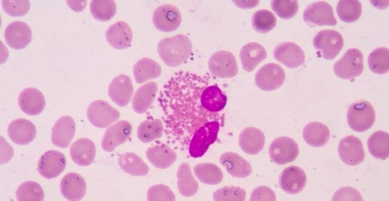 看懂血常规报告：三项重要指标解析