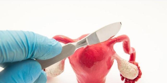 子宫切除后还能恢复正常夫妻生活吗？医生为你解答
