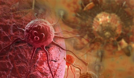 癌症难治，不必盲目求医，学会理性选择是更明智的决定