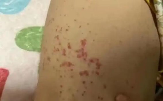 医生再三强调：宫颈癌的早期信号，早了解早预防