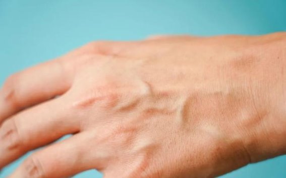 为什么有的人手上青筋暴起？这些地方出现青筋，一定要小心