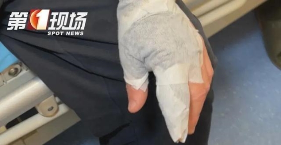 海鲜处理中的潜在风险：如何避免创伤弧菌感染