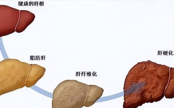 年轻人的健康危机：超越“三高”的隐忧