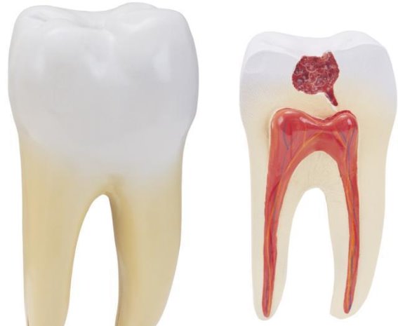 如何预防“老掉牙”？口腔健康从年轻开始