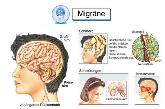 疼痛排行榜揭晓：人类最难忍受的六种病痛，究竟痛到什么程度