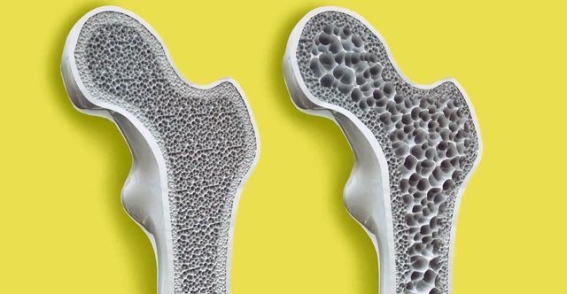 60岁后，养骨健康，牛腱子肉与猪骨汤的科学益处