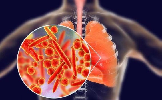 儿童支原体肺炎康复后的三大护理要点，帮助孩子恢复健康