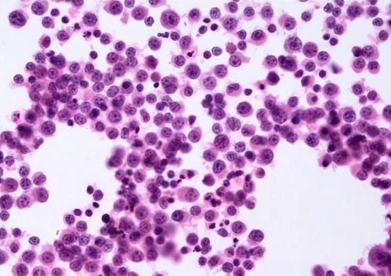 三位院士揭示防癌误区，如何科学防癌？