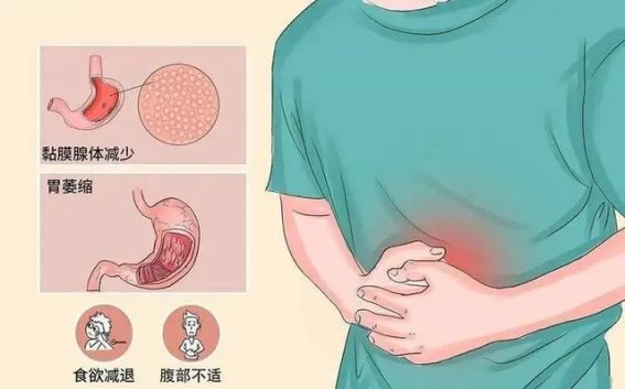李明的教训：年轻人为何不该忽视健康