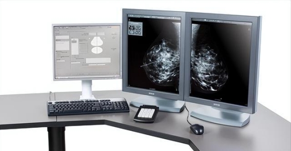 乳腺癌早期没有明显症状，定期筛查和细心观察必不可少