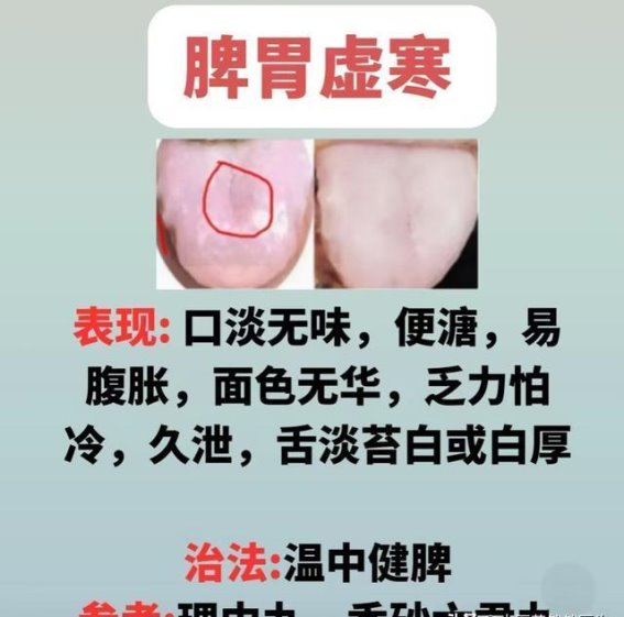 中医舌诊解密：透过舌象了解你的体质与健康状况