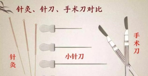 中西医结合：超声引导下针刀松解术为顽疾患者带来新希望