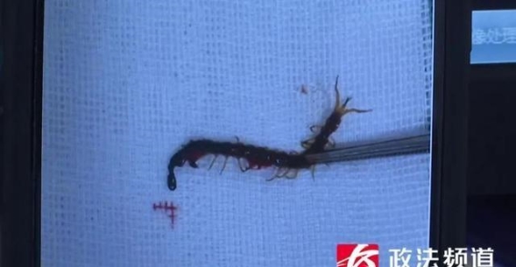 长沙男孩耳道意外发现活蜈蚣，警示我们家庭卫生的重要性